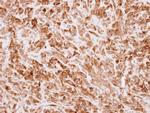 TRIP Polyclonal Antibody
