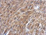 BAG2 Polyclonal Antibody