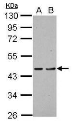 PDCD2 Polyclonal Antibody