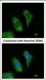TRAF5 Polyclonal Antibody