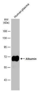 Albumin Antibody in Western Blot (WB)