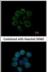 Albumin Antibody in Immunocytochemistry (ICC/IF)