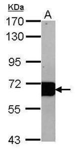 Albumin Antibody in Western Blot (WB)