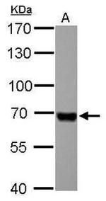 Albumin Antibody in Western Blot (WB)