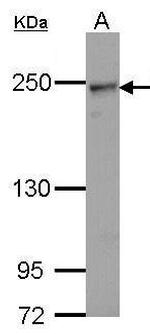 COL4A2 Polyclonal Antibody