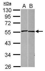 CD262 (DR5) Antibody in Western Blot (WB)