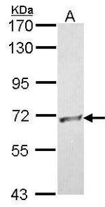 RBBP5 Antibody in Western Blot (WB)