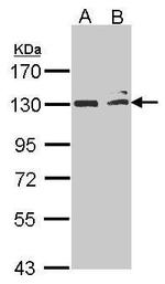 NIK Antibody in Western Blot (WB)