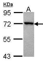 GRK3 Antibody in Western Blot (WB)