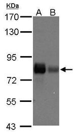 Caldesmon Antibody in Western Blot (WB)