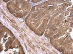 Calpain 2 Antibody in Immunohistochemistry (Paraffin) (IHC (P))