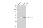 Calpain 2 Antibody in Western Blot (WB)