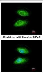 IRAK2 Polyclonal Antibody