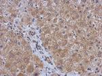 DDR2 Antibody in Immunohistochemistry (Paraffin) (IHC (P))