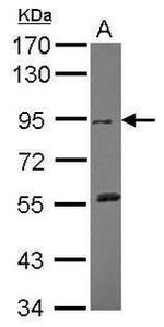 DDR2 Antibody in Western Blot (WB)