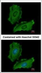 PTPN12 Polyclonal Antibody
