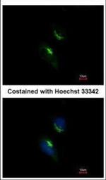 PRPS1 Polyclonal Antibody