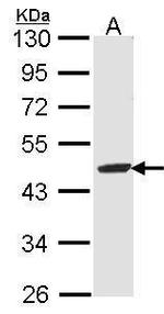 FAH Antibody in Western Blot (WB)