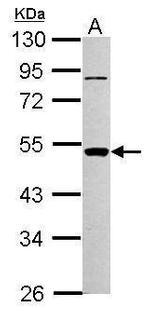 PIGA Polyclonal Antibody