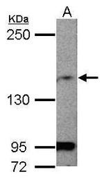 MAGI1 Polyclonal Antibody