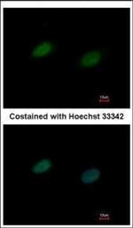 UBA2 Polyclonal Antibody