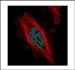 DYRK1B Polyclonal Antibody