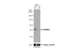 MTMR2 Polyclonal Antibody