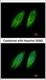 GBF1 Polyclonal Antibody