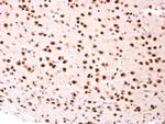 BTRC Polyclonal Antibody