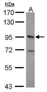 ITGB5 Polyclonal Antibody