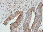 UGP2 Polyclonal Antibody