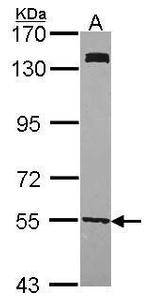UGP2 Antibody in Western Blot (WB)