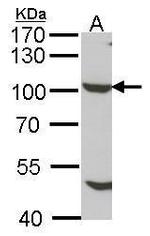 NUP98 Polyclonal Antibody