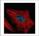 WTAP Polyclonal Antibody