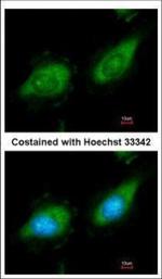 TPL2 Polyclonal Antibody