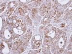 TPL2 Antibody in Immunohistochemistry (Paraffin) (IHC (P))