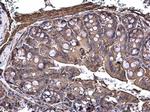 TPL2 Antibody in Immunohistochemistry (Paraffin) (IHC (P))
