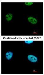WTAP Polyclonal Antibody