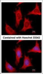 PPAT Polyclonal Antibody