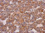 ITGA9 Polyclonal Antibody