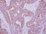 IL10RA Polyclonal Antibody