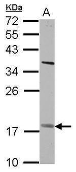 GS2 Antibody in Western Blot (WB)