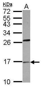 PLA2 Polyclonal Antibody