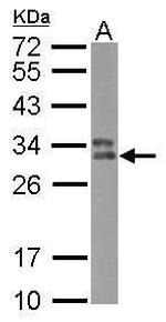 HLA-DPB1 Polyclonal Antibody