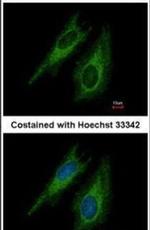 TGFBR1 Antibody in Immunocytochemistry (ICC/IF)