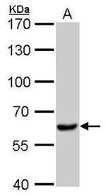 TGFBR1 Antibody in Western Blot (WB)