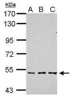 TGFBR1 Antibody in Western Blot (WB)