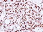 Cdc25C Antibody in Immunohistochemistry (Paraffin) (IHC (P))