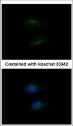 HSD3B2 Polyclonal Antibody