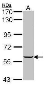IMPDH1 Polyclonal Antibody